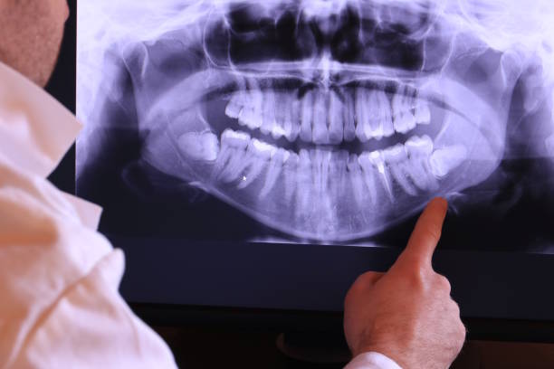 Best Emergency Treatment for Dental Infections or Abscesses in Alanes Ridge, CA