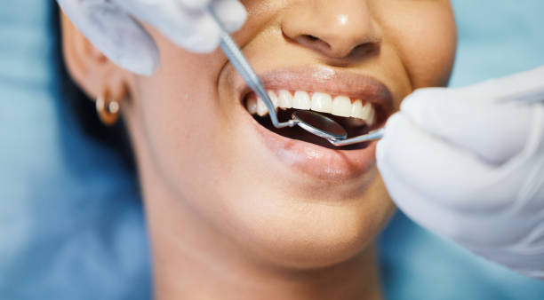 Best Emergency Treatment for Dental Infections or Abscesses in Alanes Ridge, CA