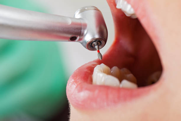 Best Emergency TMJ Treatment in Alanes Ridge, CA